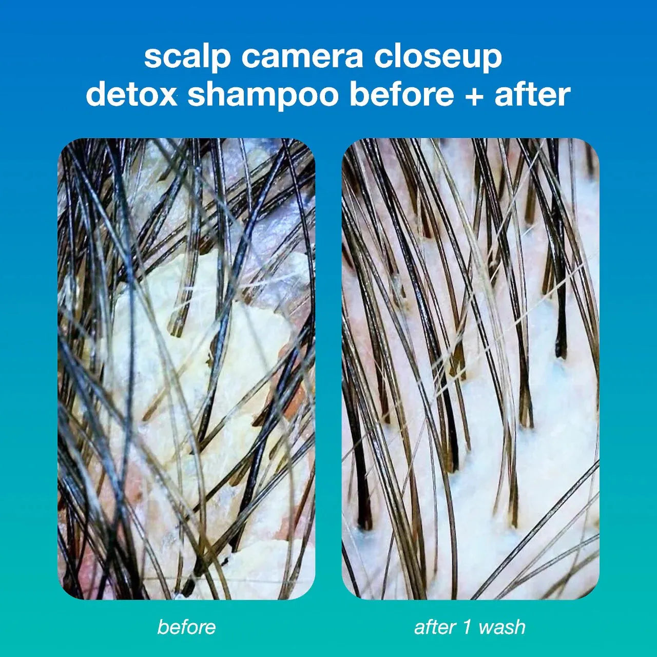 K18 PEPTIDE PREP™ Detox Shampoo